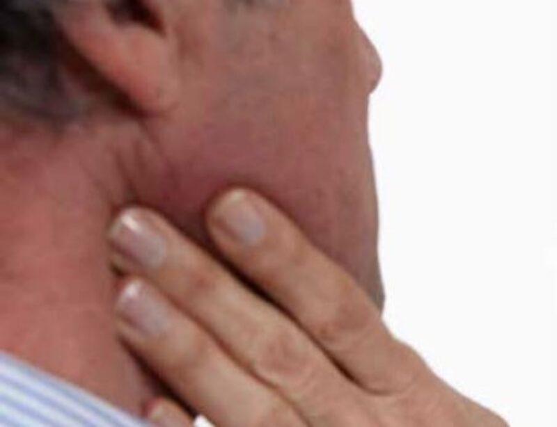 Kankers van de mond en van de speekselklieren